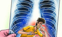 How Much Does a TB Test Cost without Insurance?