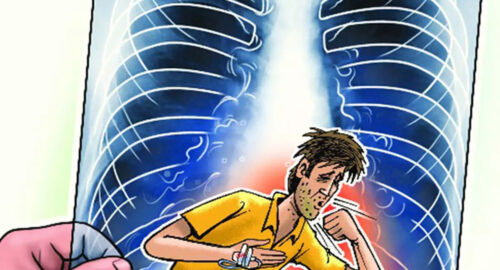 How Much Does a TB Test Cost without Insurance