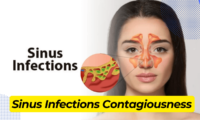 Sinus Infections Contagiousness: Debunking Common Misconceptions