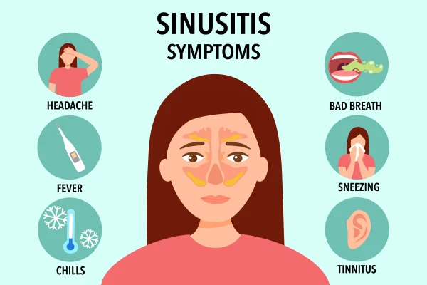 Severe sinus infection warning signs visual